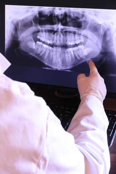 Best Emergency Dentist for Lost Fillings or Crowns in Port Dickinson, NY