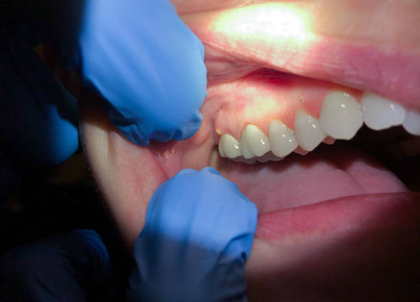 Best Orthodontic Emergency Dentist in Port Dickinson, NY